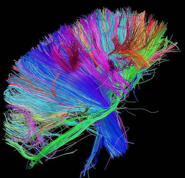 Photo: courtesy of the Laboratory of Neuro Imaging at UCLA and Martinos Center for Biomedical Imaging at MGH.