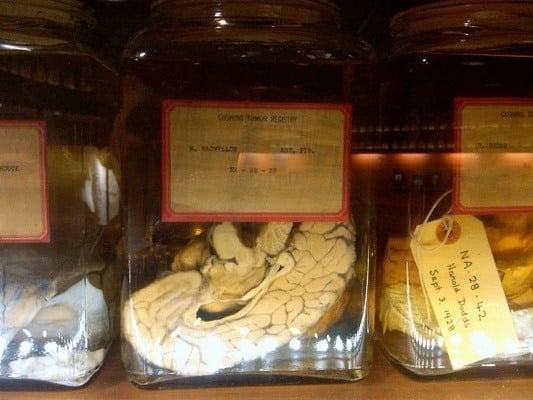 Brains on display at the Cushing Center. Photo: J.W. Ocker, via Atlas Obscura. 