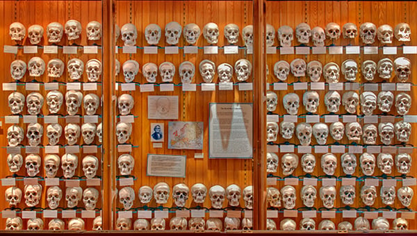 Some of the 139 human skulls in the Joseph Hyrtl collection at the Mütter Museum. Photo: courtesy the Mütter Museum.