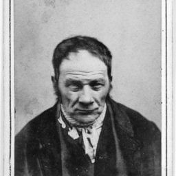 'Organic dementia' patient at West Riding Lunatic Asylum, York, UK, (circa 1869). Photo: Henry Clarke, courtesy Wellcome Library, London.