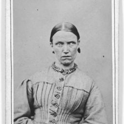 Woman suffering from general paralysis at West Riding Lunatic Asylum, York, UK, (circa 1869). Photo: James Crichton-Browne, courtesy Wellcome Library, London.