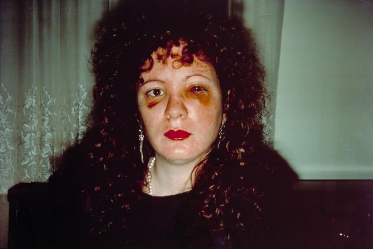 Nan Goldin, <em>Nan One Month After Being Battered</em> (1984). Photo: Nan Goldin. 