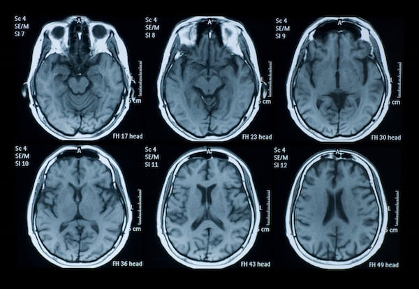 Scientists used brain scans to analyze how participants in the study reacted to different artworks. Photo: medicalplanzone.com