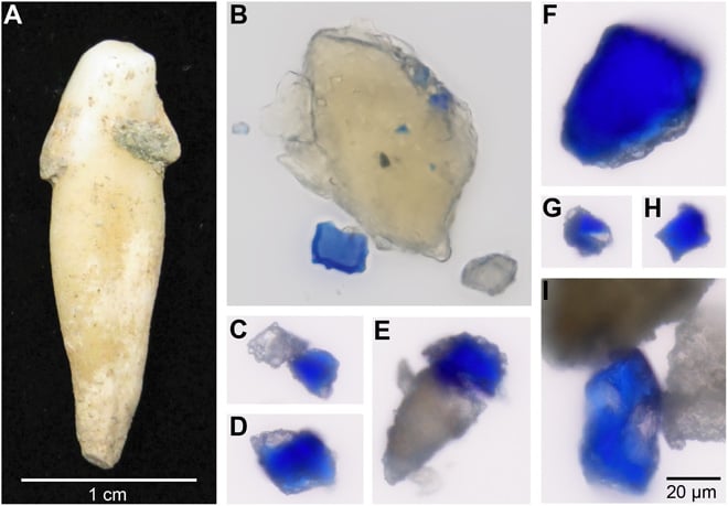 Traces of lapis lazuli were found in the dental tartar of a woman who lived at a 12-century German monastery, leading researchers to believe she was a highly skilled artist who worked on illuminated manuscripts. Courtesy of <em>Science Advances</em>. 