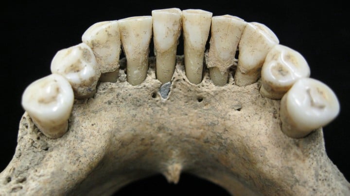 Traces of lapis lazuli were found in the dental tartar of a woman who lived at a 12-century German monastery, leading researchers to believe she was a highly skilled artist who worked on illuminated manuscripts. Courtesy of Science Advances.