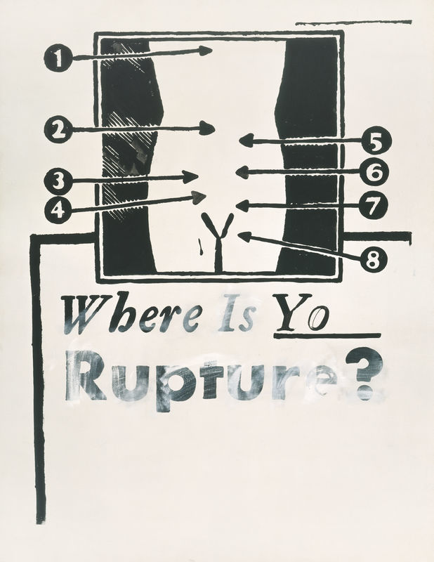 Andy Warhol, <em>Where Is Your Rupture? [1]</em> (1961). Courtesy of the Broad Art Foundation, Los Angeles. ©The Andy Warhol Foundation for the Visual Arts, Inc./Licensed by Artists Rights Society (ARS), New York.
