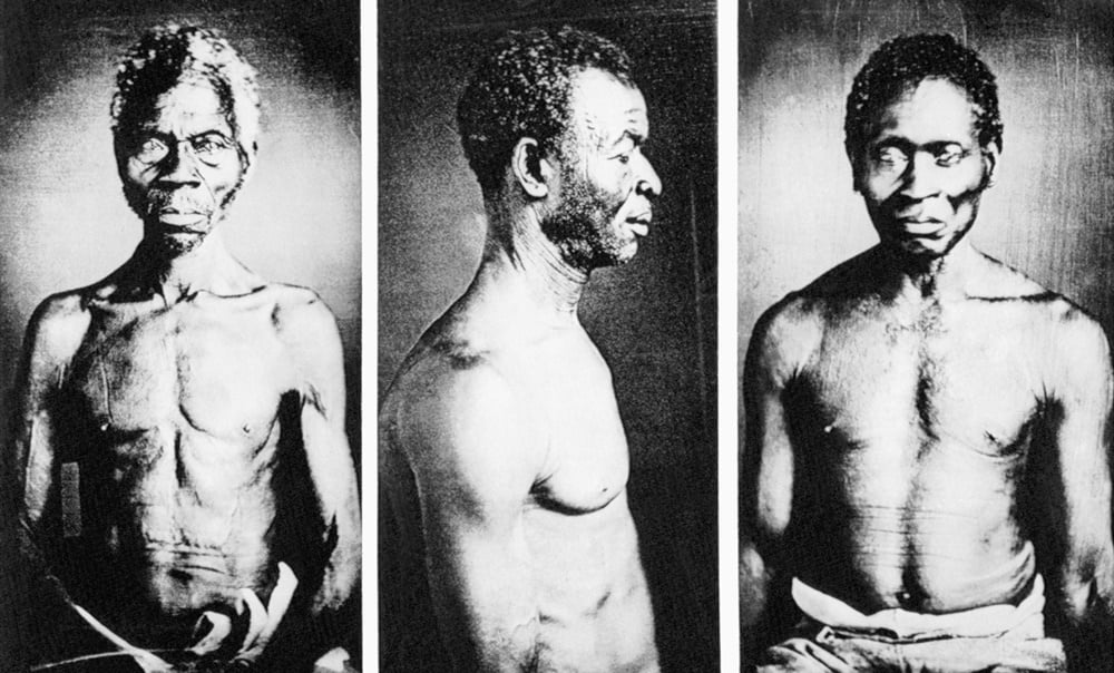 5/31/1977-Cambridge, MA- Photographs of American slaves, possibly the oldest known in the country, have been discovered in the basement of a Harvard University museum. Among the previously unpublished daguerreotypes discovered are these (L-R): a Congo slave named Renty, who lived on B.F. Taylor's plantation, "Edgehill"; Jack, a slave from the Guinea Coast (ritual scars decorate his cheek); and an unidentified man.