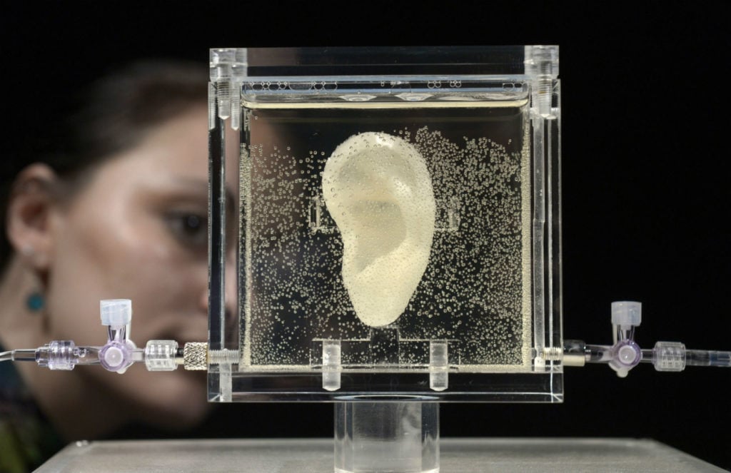 A woman looks on the living replica of Dutch painter Vincent van Gogh's famously severed ear which is displayed at Culture and media museum ZKM, in Karlsruhe, southwestern Germany, on June 4, 2014. Photo: Thomas Kienzle/AFP/Getty Images.