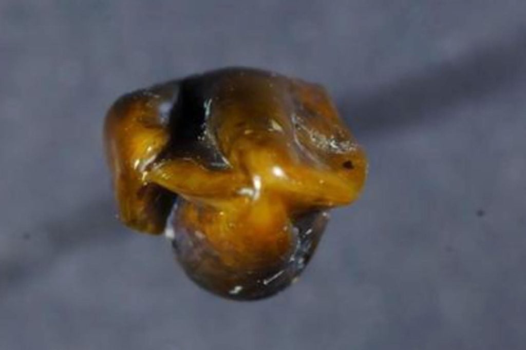 Researchers say that this tooth—recently discovered at a fossil site in Germany—is the upper left canine of an ancient Eurasian primate. (From this angle, the canine's tip is jutting outward.) Photo courtesy of Herbert Lutz.