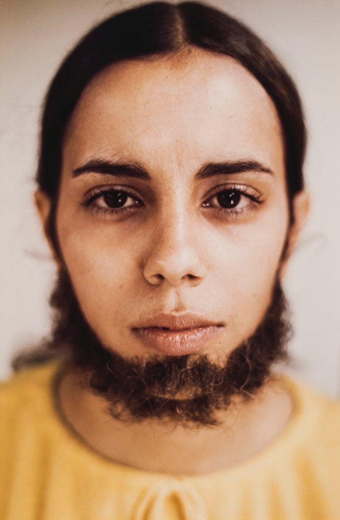 Ana Mendieta, Untitled (Facial Hair Transplants) (1972). ©The Estate of Ana Mendieta Collection, LLC, Courtesy of Galerie Lelong & Co. and Alison Jacques Gallery, London. Licensed by Artists Rights Society (ARS), New York.