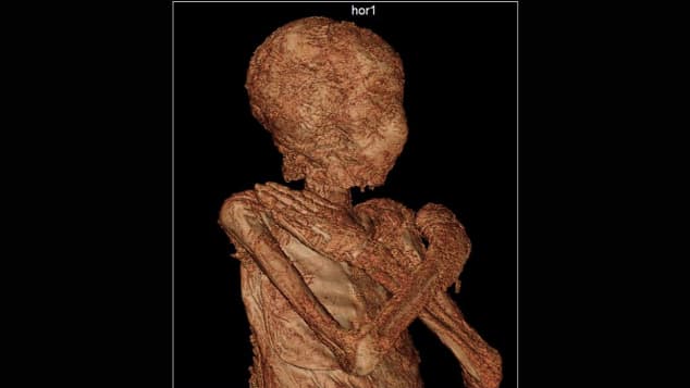 The world's first pregnant mummy, as seen in a scan. Photo courtesy of the Warsaw Mummy Project. 