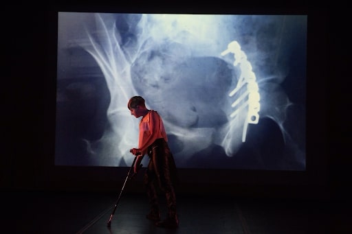 (do not) despair solo (2018). Performance, Abrons Art Center. Image credit: Ian Douglas. Image Description: On stage, Perel leans across their cane in front of an X-Ray projection showing screws and a rod inside of a hip socket. They wear black leather pants, and a golden sleeveless top lit up by a pink light from the side.