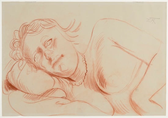 Otto Dix, Reclining Female Nude, Half Figure (1929). Courtesy of Egan and Rosen, New York.