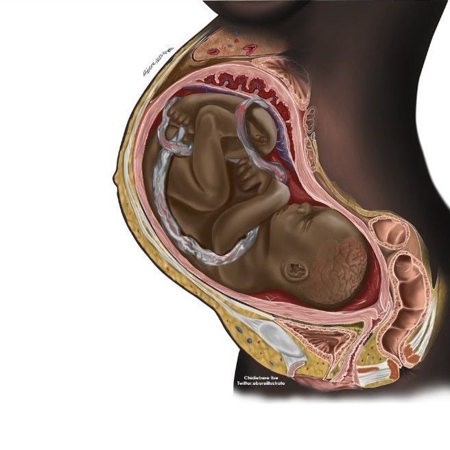 Chidiebere Ibe's illustration of a Black fetus is part of the medical student and self-taught artist's push to promote representation of the Black body in medical diagrams.