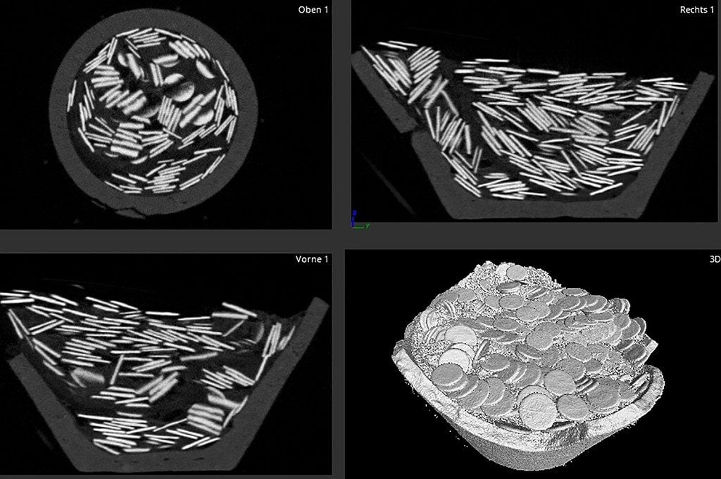 Röntgenaufnahmen von Münzen.  Archäologische Bilder