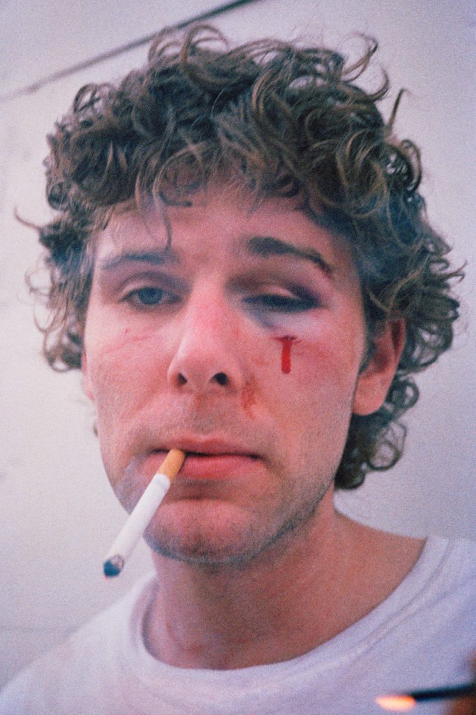 Ryan McGinley, Dan (Bloody Eye) (2002). 