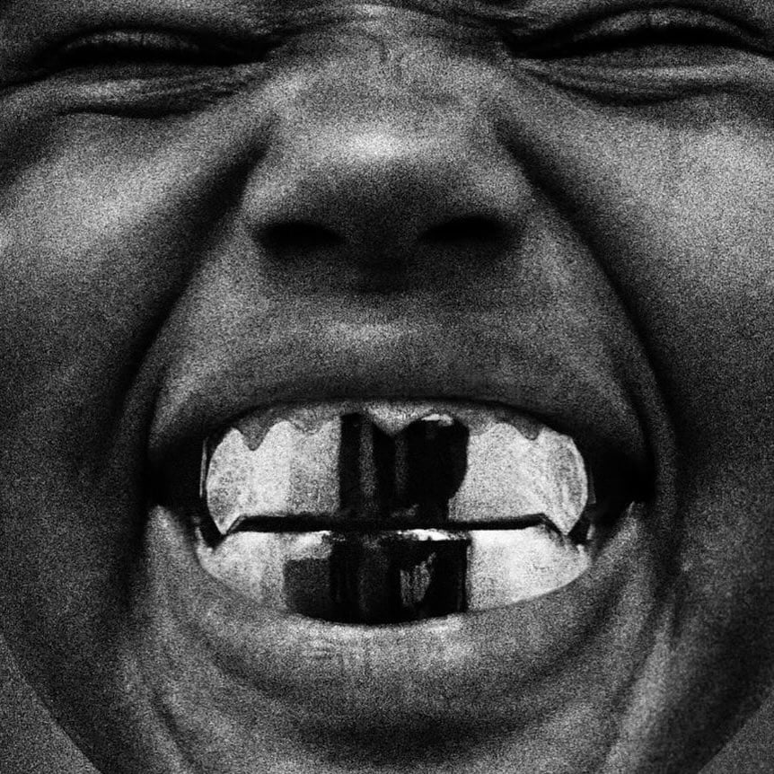 A woman grinning to show her front teeth stained black