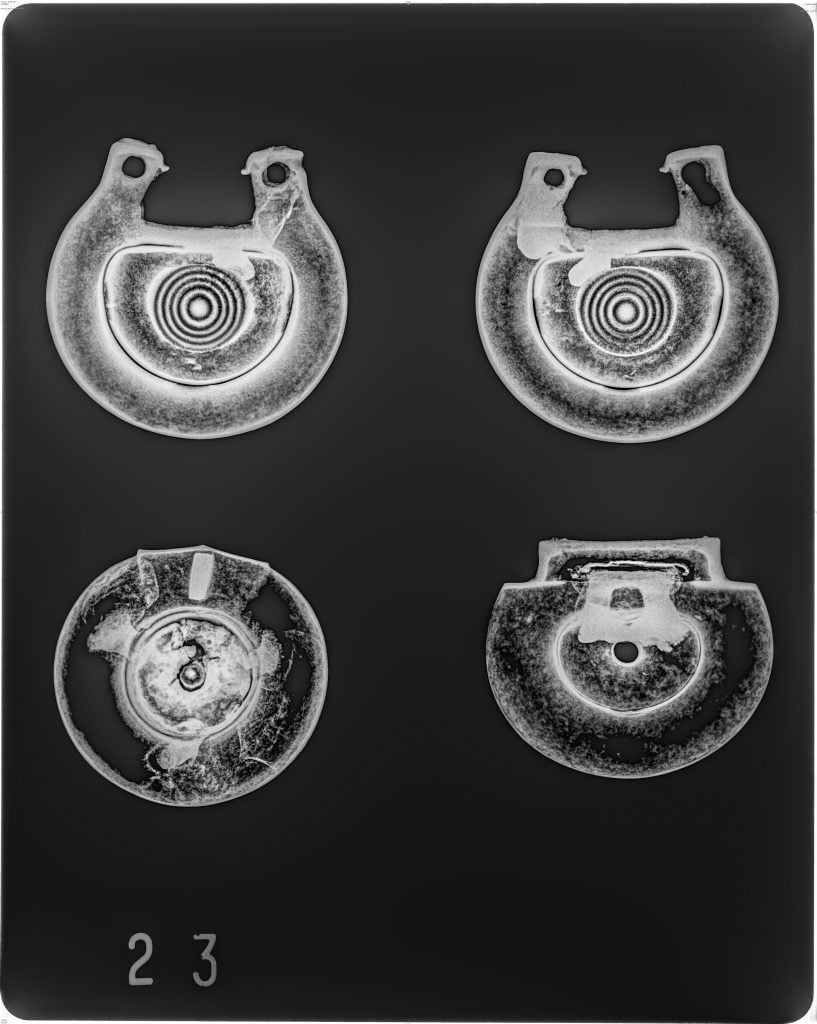 X-ray of four Bronze Age objects from the Peebles Hoard. The objects appear to be decorated bronze fittings and buttons.